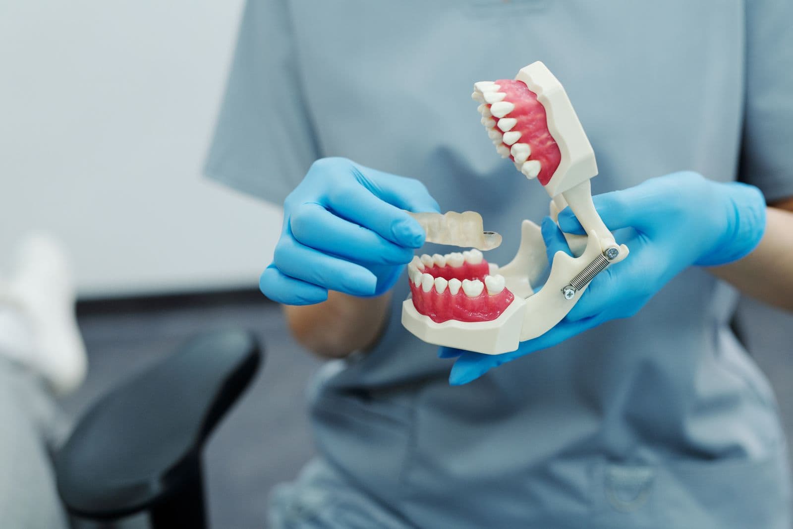 Dental crown and bridge prosthetic models