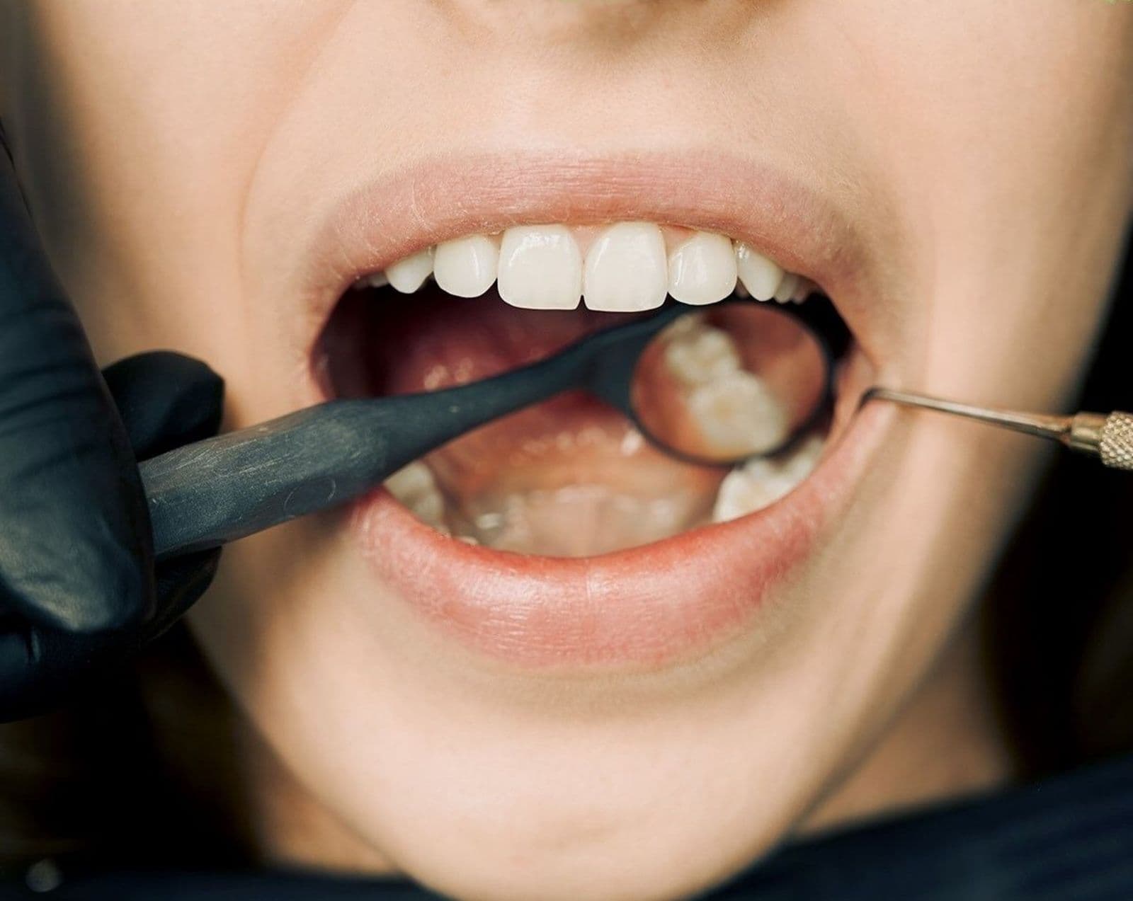 Modern dental laser device used for gum contouring