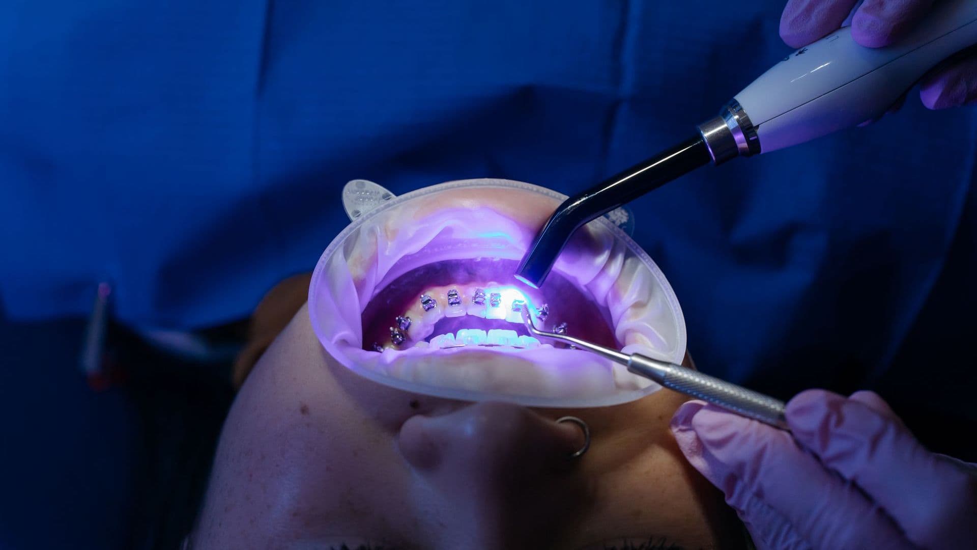 Patient receiving a laser gum treatment