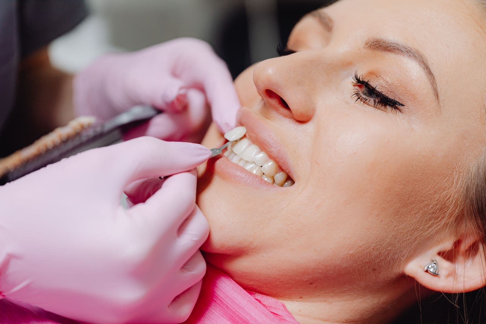 Dentist fitting a porcelain veneer for a patient