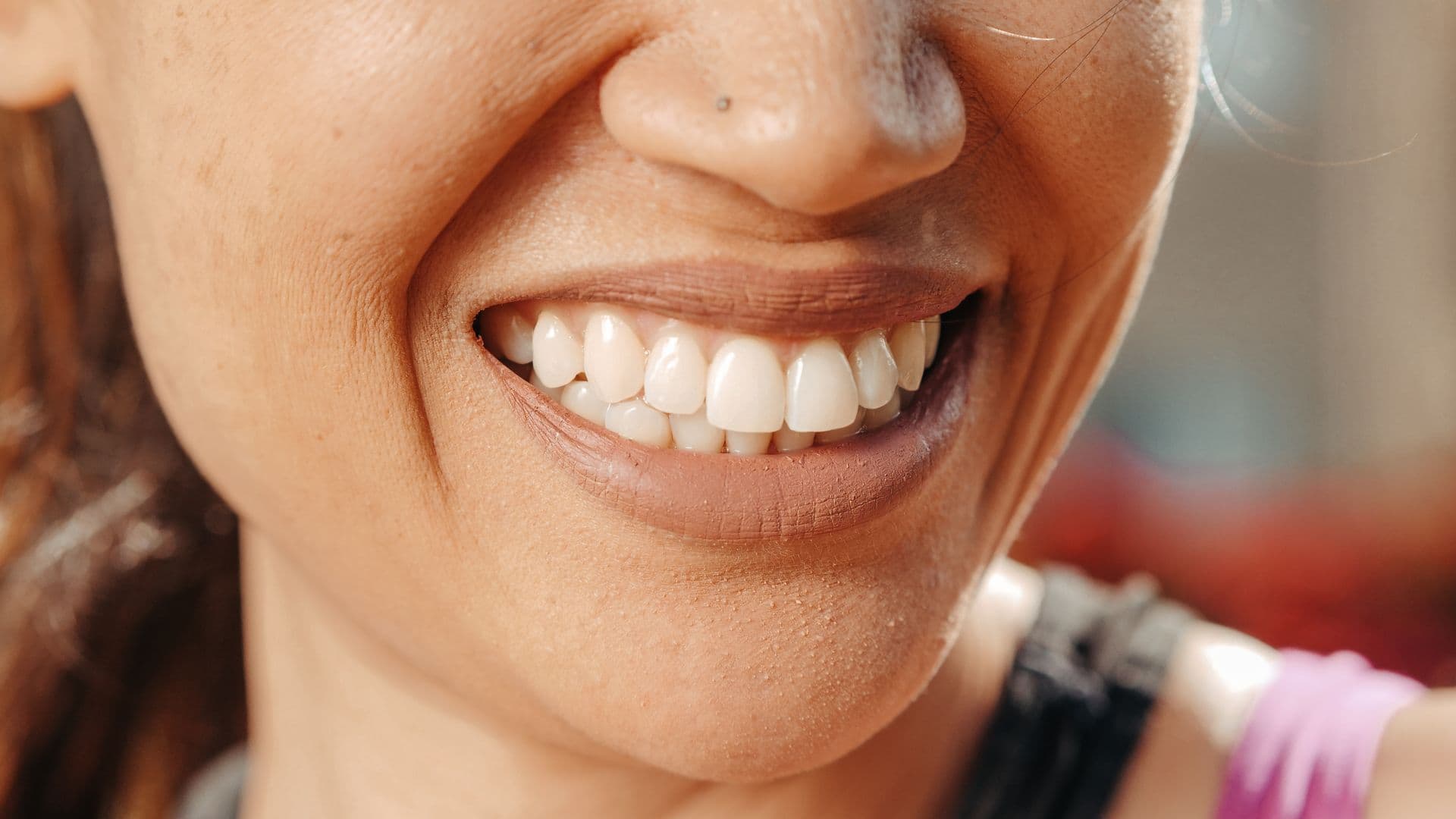 Bright, natural-looking porcelain veneers smile