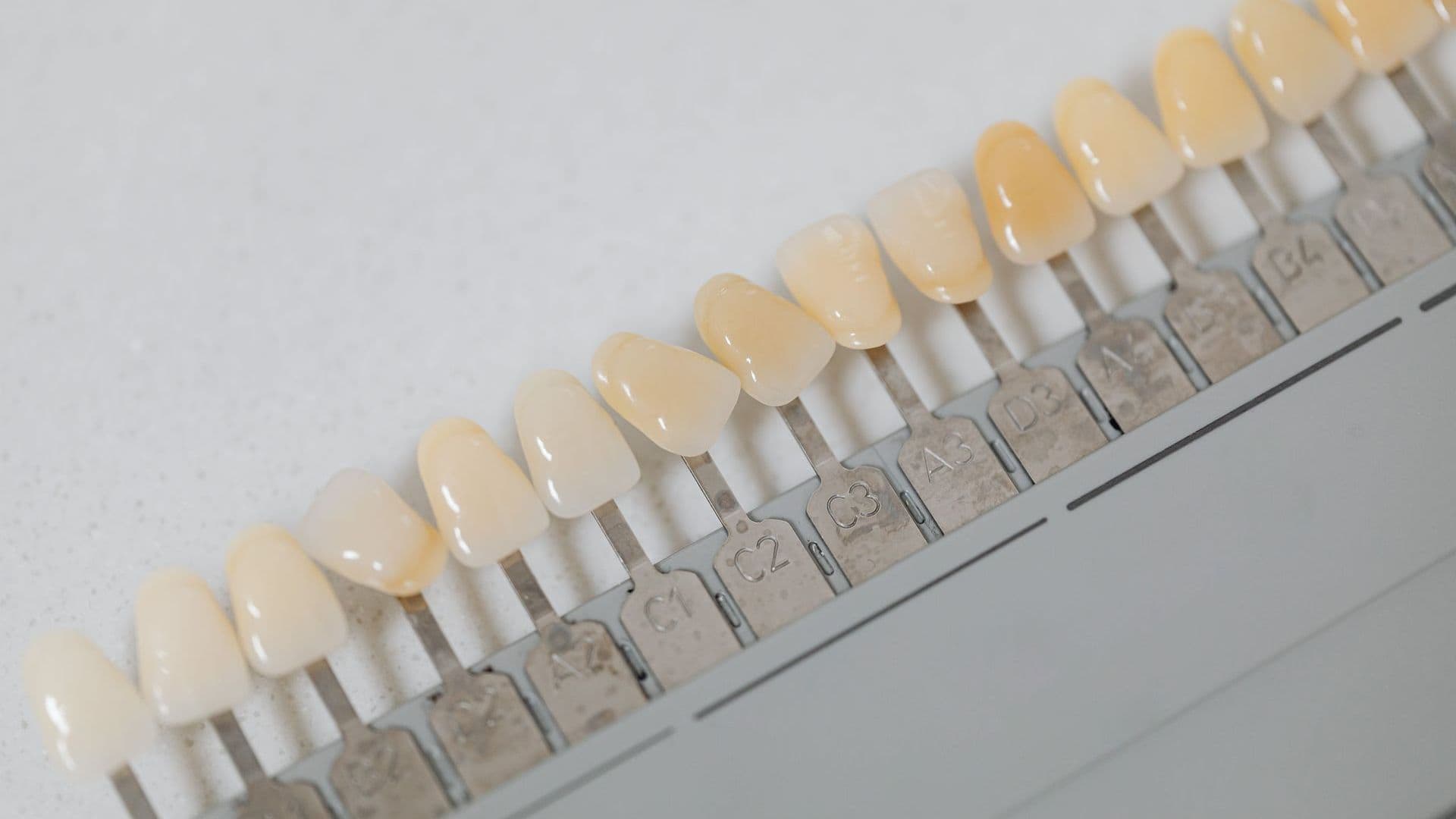Close-up of bright, white teeth after whitening treatment