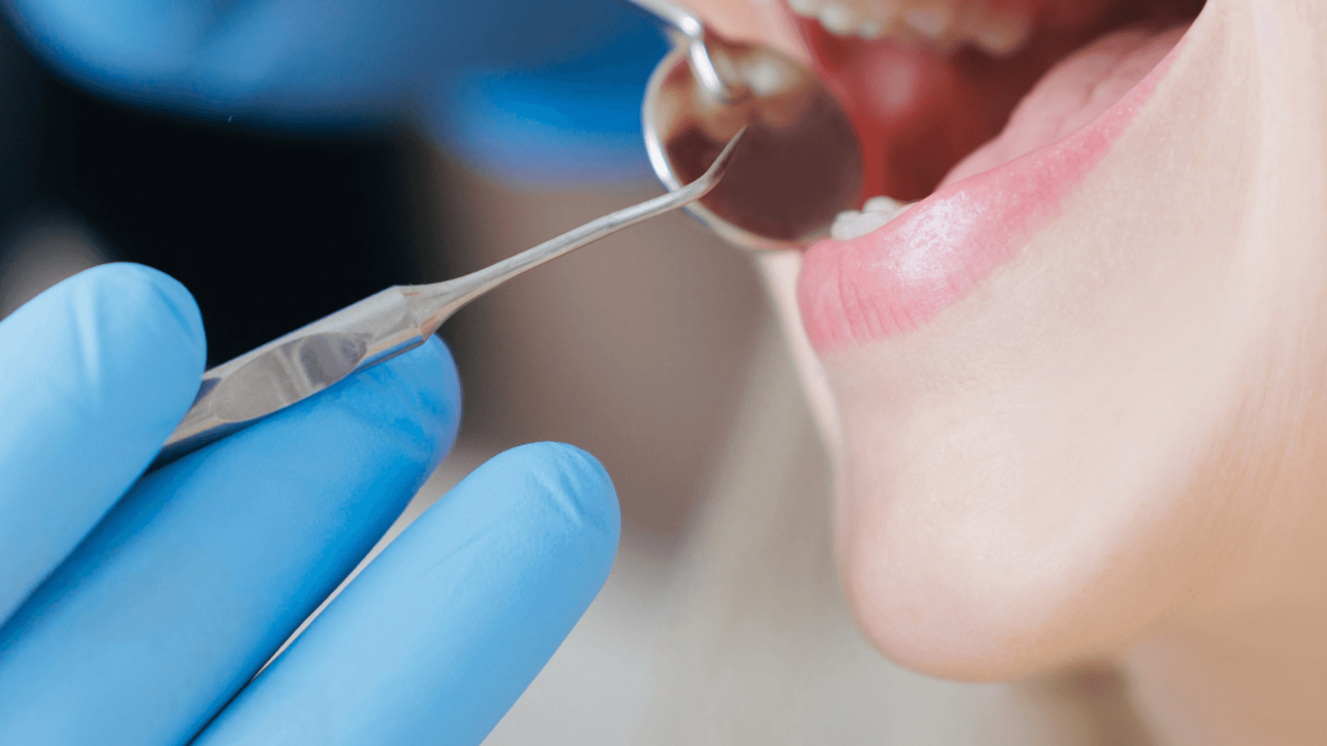 Dental